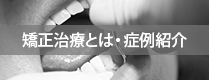 矯正治療とは症例紹介