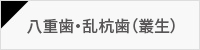 八重歯・乱杭歯（叢生）