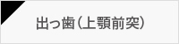 出っ歯（上顎前突）
